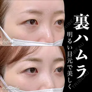 EMMO FACE CLINIC 大宮院 百瀬 直也医師の症例