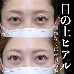 EMMO FACE CLINIC 大宮院 百瀬 直也医師の症例