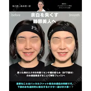 PRISM Beauty Clinic 町田院の症例