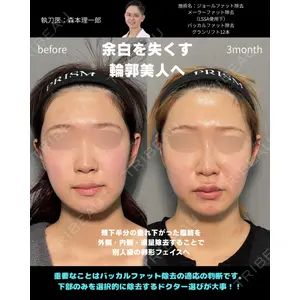 PRISM Beauty Clinic 町田院の症例