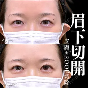 EMMO FACE CLINIC 大宮院 百瀬 直也医師の症例