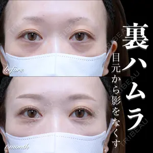 EMMO FACE CLINIC 大宮院 百瀬 直也医師の症例