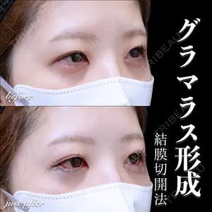 EMMO FACE CLINIC 大宮院 百瀬 直也医師の症例