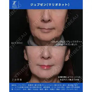 Zetith Beauty Clinic 新宿院 新井佑梨医師の症例