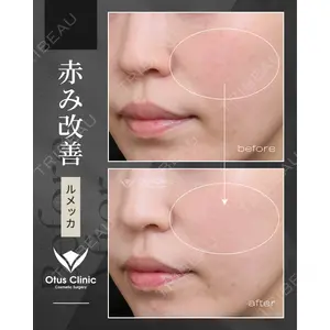 Otus Clinic 【オータスクリニック】 中 徳太郎医師の症例