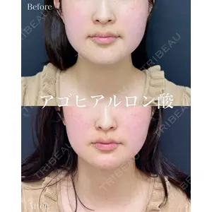 ルラ美容クリニック 名古屋本院 山本 美佳医師の症例