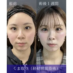 ルラ美容クリニック 名古屋本院 鶴田 佳雅医師の症例