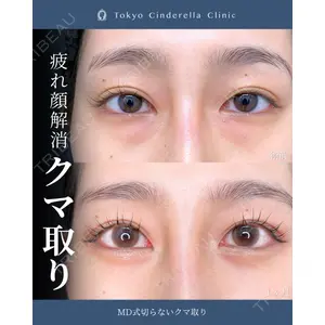 東京シンデレラ美容外科 新宿院 吉原 伯医師の症例