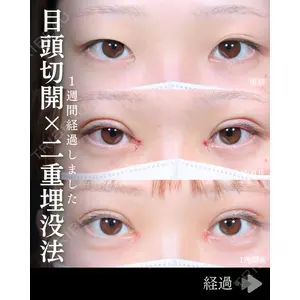 東京シンデレラ美容外科 池袋院 石井 達也医師の症例