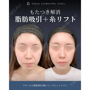 東京シンデレラ美容外科 新宿院 吉原 伯医師の症例