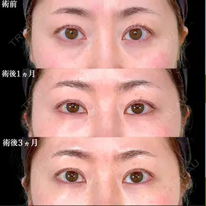 アリエル美容クリニック 水戸院 天白 典秀医師の症例
