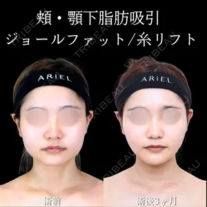 アリエル美容クリニック 横浜院 渡邉 光医師の症例