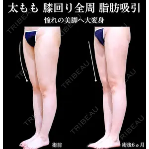 アリエル美容クリニック 横浜院 加藤 敏次医師の症例