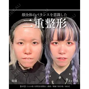 東京シンデレラ美容外科 大宮院 竹田 昌平医師の症例