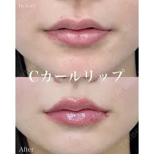 ルラ美容クリニック 名古屋本院 山本 美佳医師の症例