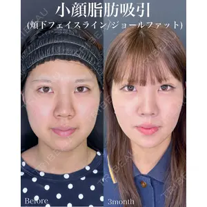 ルラ美容クリニック 名古屋本院 山本 美佳医師の症例