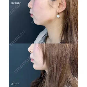 ルラ美容クリニック 名古屋本院 山本 美佳医師の症例