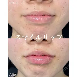 ルラ美容クリニック 名古屋本院 山本 美佳医師の症例