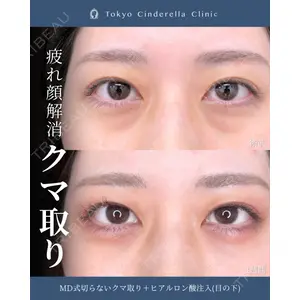 東京シンデレラ美容外科 新宿院 吉原 伯医師の症例