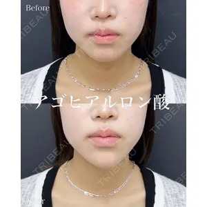 ルラ美容クリニック 名古屋本院 山本 美佳医師の症例