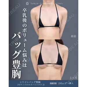 東京シンデレラ美容外科 新宿院 吉原 伯医師の症例