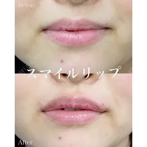 ルラ美容クリニック 名古屋本院 山本 美佳医師の症例