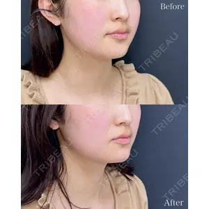 ルラ美容クリニック 名古屋本院 山本 美佳医師の症例