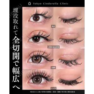 東京シンデレラ美容外科 新宿院 吉原 伯医師の症例