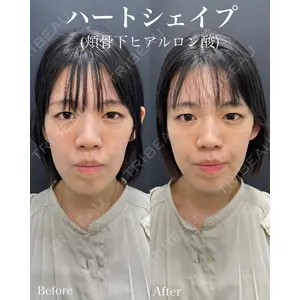 ルラ美容クリニック 名古屋本院 山本 美佳医師の症例