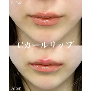 ルラ美容クリニック 名古屋本院 山本 美佳医師の症例