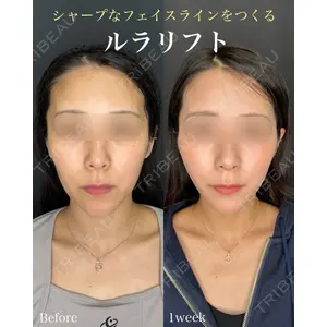 ルラ美容クリニック 名古屋本院 山本 美佳医師の症例