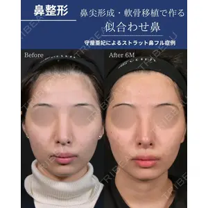 Zetith Beauty Clinic 銀座院 守屋 亜妃医師の症例