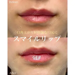 ルラ美容クリニック 名古屋本院 山本 美佳医師の症例