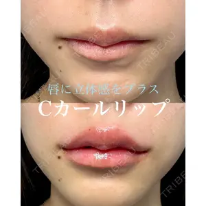 ルラ美容クリニック 名古屋本院 山本 美佳医師の症例