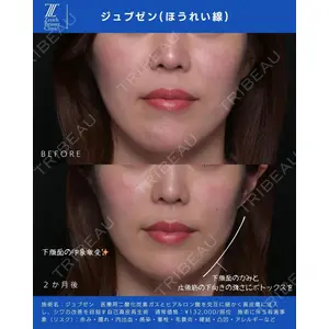 Zetith Beauty Clinic 新宿院 新井佑梨医師の症例
