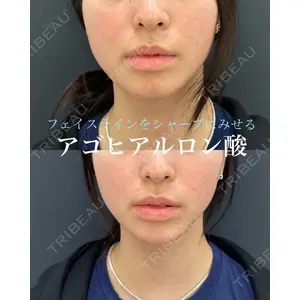 ルラ美容クリニック 名古屋本院 山本 美佳医師の症例