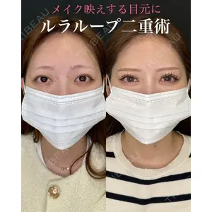 ルラ美容クリニック 名古屋本院 山本 美佳医師の症例