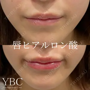 YBC横浜美容外科 池袋院の症例