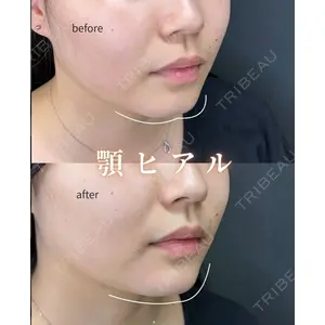 ルラ美容クリニック 神戸院 井口 宙樹医師の症例