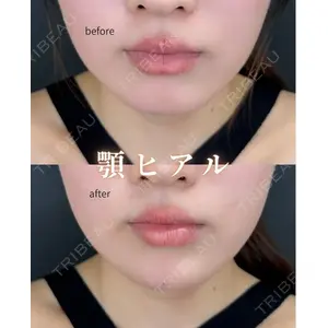 ルラ美容クリニック 神戸院の症例