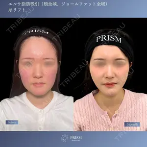 PRISM Beauty Clinic 新宿院 畑山 知輝医師の症例