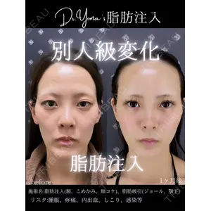 EMMO FACE CLINIC 大阪梅田院 松本洋麻医師の症例