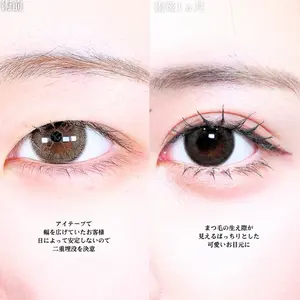アリエル美容クリニック 大宮院 江郷隼一郎医師の症例