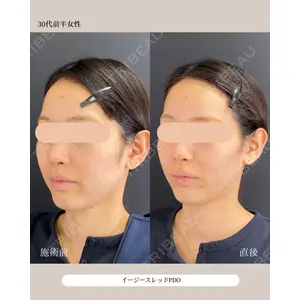 自由が丘ウェルエイジングビューティークリニック 福田 知佐子医師の症例