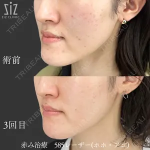 ziz CLINIC 村岡 史子医師の症例