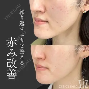 ziz CLINIC 村岡 史子医師の症例