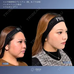 PRISM Beauty Clinic 新宿院 畑山 知輝医師の症例