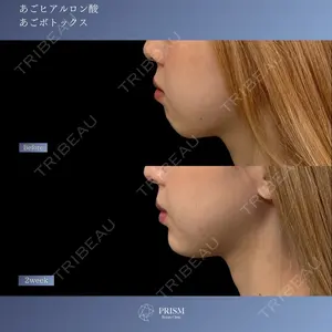 PRISM Beauty Clinic 新宿院 畑山 知輝医師の症例