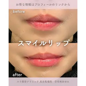 ルラ美容クリニック 高田馬場院 日名地 あゆみ医師の症例
