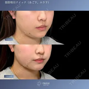 PRISM Beauty Clinic 新宿院 畑山 知輝医師の症例